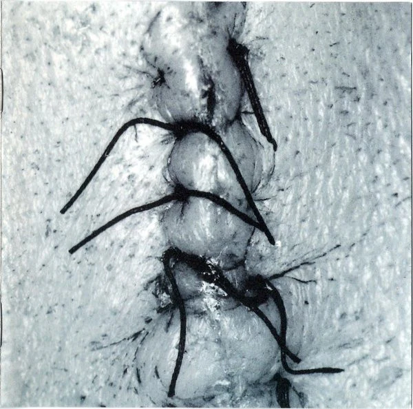 SCHEER | INFLICTION